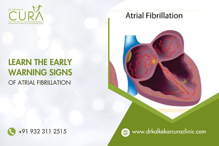 Learn the Early Warning Signs of Atrial Fibrillation
